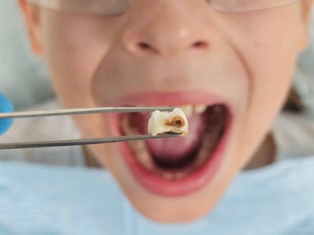 Best Emergency Root Canal Treatment in Amboy, IL